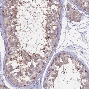 Anti-NR1H3 antibody produced in rabbit Prestige Antibodies&#174; Powered by Atlas Antibodies, affinity isolated antibody, buffered aqueous glycerol solution