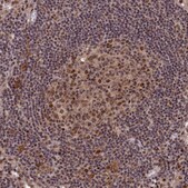 Anti-BRCA1 antibody produced in rabbit Prestige Antibodies&#174; Powered by Atlas Antibodies, affinity isolated antibody, buffered aqueous glycerol solution