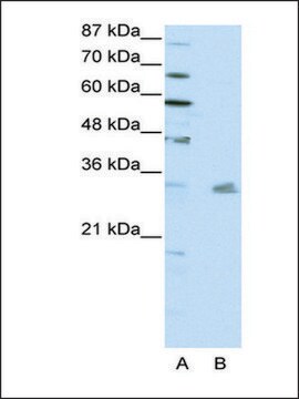 Anti-PITX3 antibody produced in rabbit affinity isolated antibody