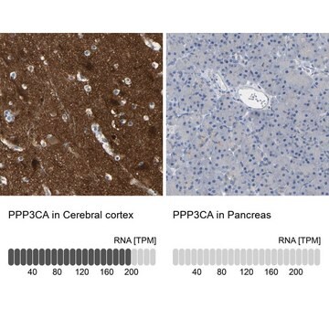 Anti-PPP3CA antibody produced in rabbit Prestige Antibodies&#174; Powered by Atlas Antibodies, affinity isolated antibody, buffered aqueous glycerol solution