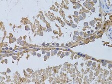 Anti-HDAC8 antibody produced in rabbit