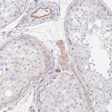 Anti-TSPAN19 antibody produced in rabbit Prestige Antibodies&#174; Powered by Atlas Antibodies, affinity isolated antibody, buffered aqueous glycerol solution