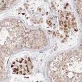 Anti-GGH antibody produced in rabbit Prestige Antibodies&#174; Powered by Atlas Antibodies, affinity isolated antibody, buffered aqueous glycerol solution