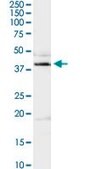Anti-ADA antibody produced in rabbit purified immunoglobulin, buffered aqueous solution
