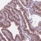 Anti-UBN1 antibody produced in rabbit Prestige Antibodies&#174; Powered by Atlas Antibodies, affinity isolated antibody, buffered aqueous glycerol solution