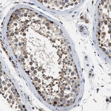 Anti-STK33 antibody produced in rabbit Prestige Antibodies&#174; Powered by Atlas Antibodies, affinity isolated antibody, buffered aqueous glycerol solution