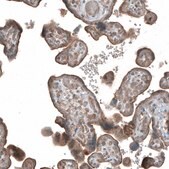 Anti-HMGCR antibody produced in rabbit Prestige Antibodies&#174; Powered by Atlas Antibodies, affinity isolated antibody, buffered aqueous glycerol solution