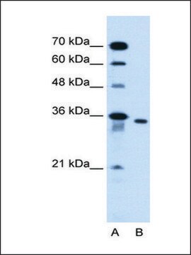 Anti-SLC25A32 affinity isolated antibody