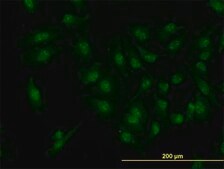 Monoclonal Anti-CDK6 antibody produced in mouse clone 8H4, purified immunoglobulin, buffered aqueous solution
