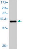 Monoclonal Anti-MAP3K1 antibody produced in mouse clone 2F6, purified immunoglobulin, buffered aqueous solution