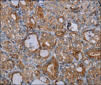 Anti-CYP7A1 antibody produced in rabbit affinity isolated antibody