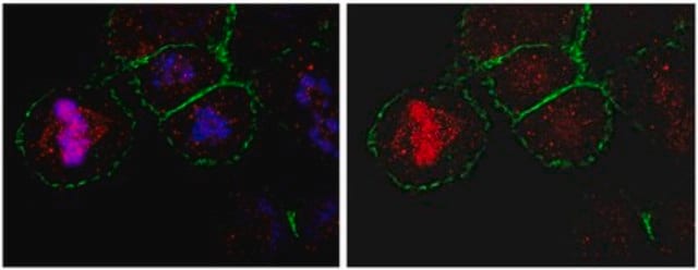 Anti-CKAP5 Antibody from rabbit, purified by affinity chromatography