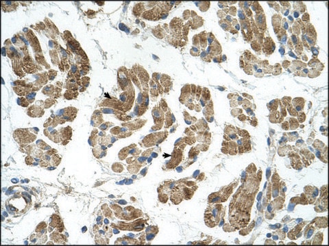 Anti-RHOT1 antibody produced in rabbit affinity isolated antibody