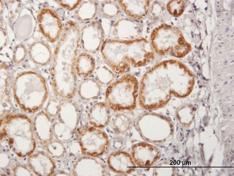 Anti-ACADM antibody produced in mouse purified immunoglobulin, buffered aqueous solution