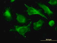 Monoclonal Anti-B2M antibody produced in mouse clone 3F9-2C2, purified immunoglobulin, buffered aqueous solution