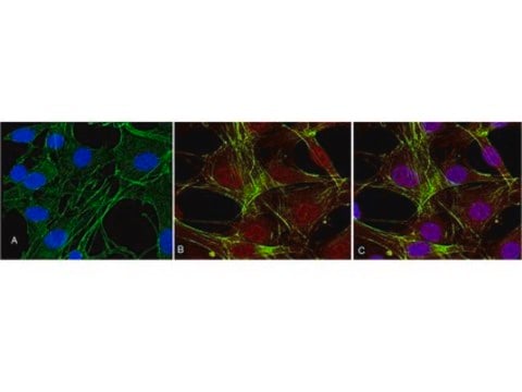 Anti-phospho-Akt (Thr308) Antibody, clone 50-1C-25, rabbit monoclonal clone NL50, Upstate&#174;, from rabbit