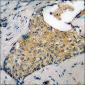 Anti-phospho-PKC &#945; (pTyr658) antibody produced in rabbit affinity isolated antibody