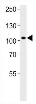 ANTI-TRKC antibody produced in rabbit purified immunoglobulin, buffered aqueous solution