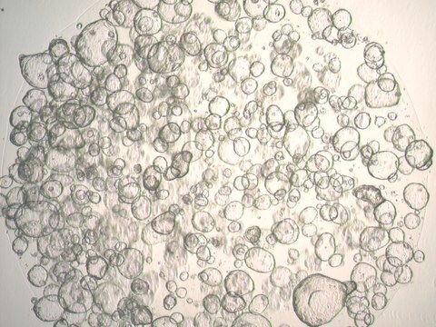 3dGRO Colon Intestinal Organoids, Age 24 (Prep ht-206-CR)