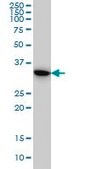 Monoclonal Anti-TYMS antibody produced in mouse clone 3A1, purified immunoglobulin, buffered aqueous solution