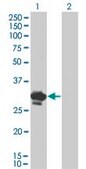Monoclonal Anti-BDNF antibody produced in mouse clone 1B10, purified immunoglobulin, buffered aqueous solution