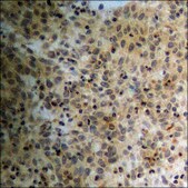 Anti-phospho-PPAR-&#947; (pSer112) antibody produced in rabbit affinity isolated antibody