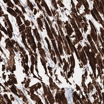 Anti-NBAS antibody produced in rabbit Prestige Antibodies&#174; Powered by Atlas Antibodies, affinity isolated antibody, buffered aqueous glycerol solution