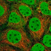 Anti-SRA1 antibody produced in rabbit Prestige Antibodies&#174; Powered by Atlas Antibodies, affinity isolated antibody, buffered aqueous glycerol solution