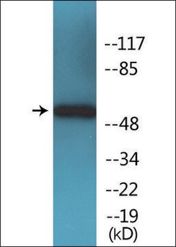 Anti-phospho-SOX-9 (pSer181) antibody produced in rabbit affinity isolated antibody