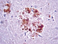 Anti-APP A4 Antibody, a.a. 66-81 of APP {NT}, clone 22C11 clone 22C11, Chemicon&#174;, from mouse