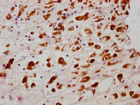 Anti-phospho-MLKL (S358) antibody, clone 4A6, Rabbit Monoclonal recombinant, expressed in HEK293F cells