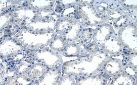 Anti-TRPV1 Antibody, clone 1N19 ZooMAb&#174; Rabbit Monoclonal recombinant, expressed in HEK 293 cells