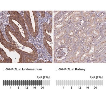 Anti-LRRN4CL antibody produced in rabbit Prestige Antibodies&#174; Powered by Atlas Antibodies, affinity isolated antibody, buffered aqueous glycerol solution