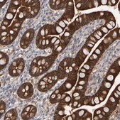 Anti-EPHX2 antibody produced in rabbit Prestige Antibodies&#174; Powered by Atlas Antibodies, affinity isolated antibody, buffered aqueous glycerol solution, Ab1