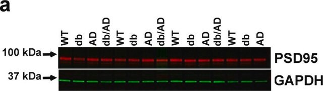 Anti-Glial Fibrillary Acidic Protein antibody produced in rabbit IgG fraction of antiserum, buffered aqueous solution