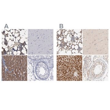 Anti-PYGL antibody produced in rabbit Prestige Antibodies&#174; Powered by Atlas Antibodies, affinity isolated antibody, buffered aqueous glycerol solution