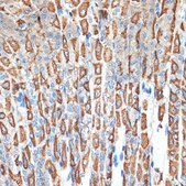 Anti-ATP4B antibody produced in rabbit