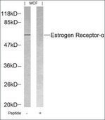 Anti-ESR1 (Ab-118) antibody produced in rabbit affinity isolated antibody