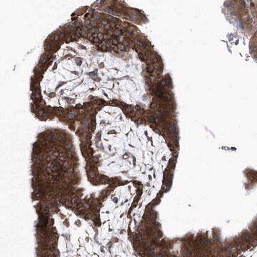 Anti-EIF3M antibody produced in rabbit Prestige Antibodies&#174; Powered by Atlas Antibodies, affinity isolated antibody, buffered aqueous glycerol solution