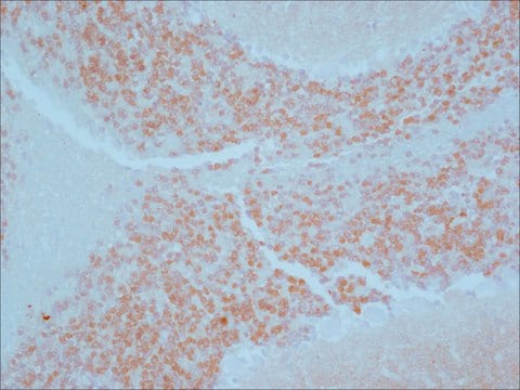 Anti-Calretinin antibody produced in rabbit affinity isolated antibody, buffered aqueous solution