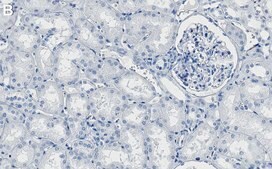 Anti-PI-3 kinase p110&#945; Antibody, clone 1J4 ZooMAb&#174; Rabbit Monoclonal recombinant, expressed in HEK 293 cells