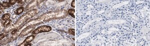 Anti-Na+/K+ ATPase &#945;-1 Antibody, clone C464.6 ZooMAb&#174; Mouse Monoclonal recombinant, expressed in HEK 293 cells