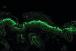 Monoclonal Anti-Nitrotyrosine antibody produced in mouse clone 39B6, 1&#160;mg/mL, purified immunoglobulin