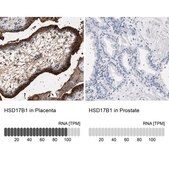 Anti-HSD17B1 antibody produced in rabbit Prestige Antibodies&#174; Powered by Atlas Antibodies, affinity isolated antibody, buffered aqueous glycerol solution