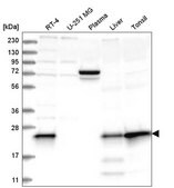Anti-MGMT antibody produced in rabbit Prestige Antibodies&#174; Powered by Atlas Antibodies, affinity isolated antibody