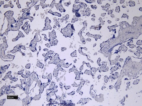Anti-CD32/FCGR2B antibody produced in goat affinity isolated antibody, buffered aqueous solution
