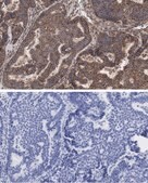 Anti-Beclin 1 Antibody, clone 1E22 , ZooMAb&#174; Rabbit Monoclonal recombinant, expressed in HEK 293 cells