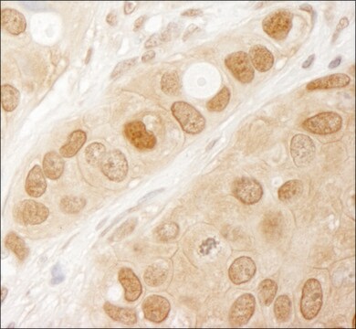 Rabbit anti-AKT1 Antibody, Affinity Purified Powered by Bethyl Laboratories, Inc.