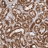 Anti-FH antibody produced in rabbit Prestige Antibodies&#174; Powered by Atlas Antibodies, affinity isolated antibody, buffered aqueous glycerol solution, ab3