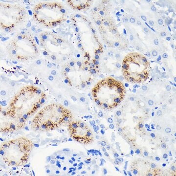 Anti- Fas antibody produced in rabbit